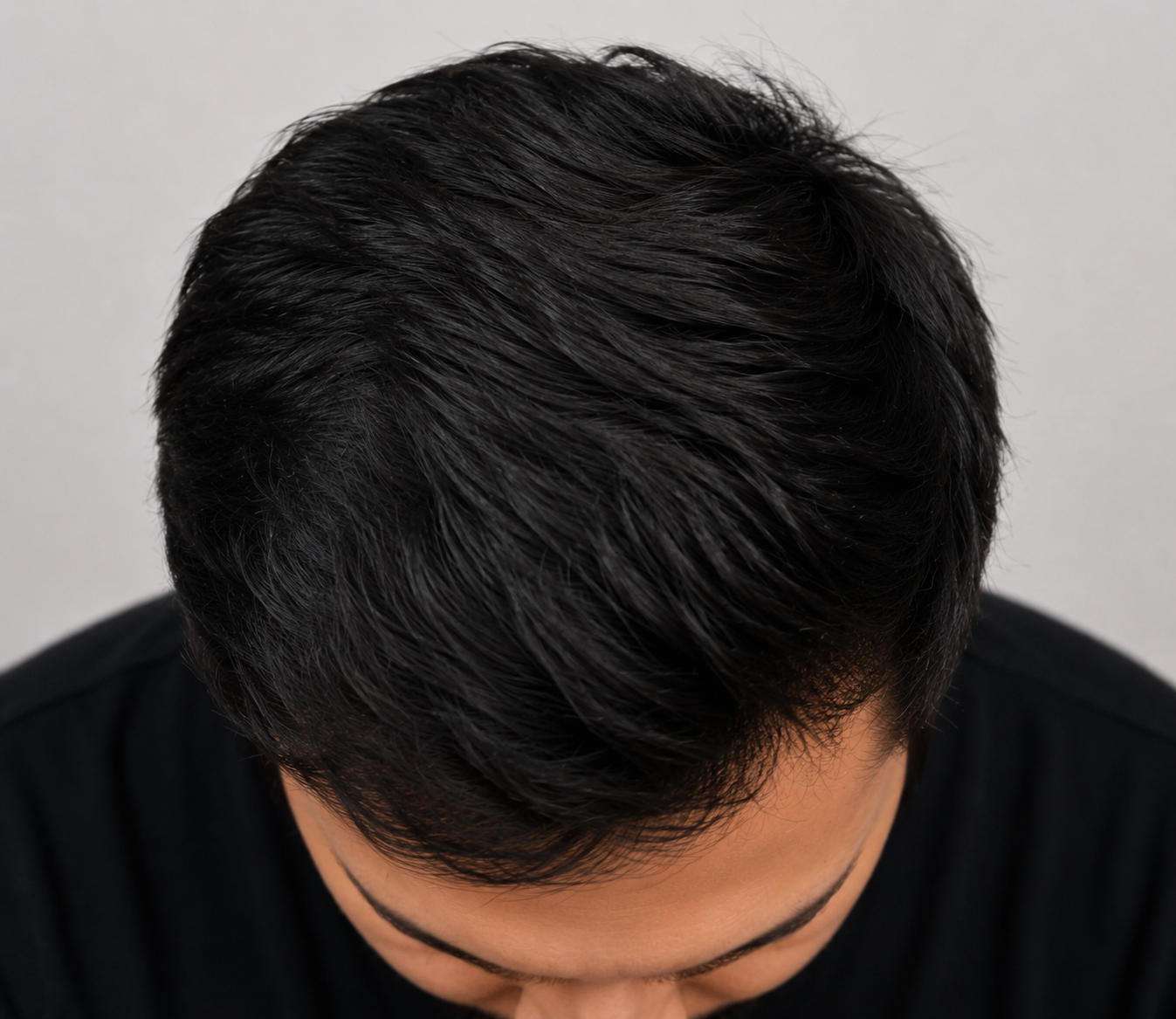 After